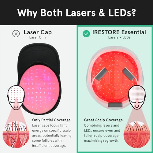 iRestore Essential Laser Hair Growth System - FDA Cleared Hair Loss Treatments for Men & Women & Hair Growth Products for Men with Thinning Hair, Hair Regrowth Treatments Laser Cap, Red Light Therapy