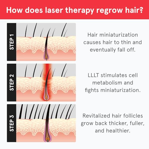 iRestore Essential Laser Hair Growth System - FDA Cleared Hair Loss Treatments for Men & Women & Hair Growth Products for Men with Thinning Hair, Hair Regrowth Treatments Laser Cap, Red Light Therapy